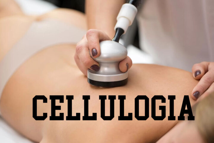Cellulogia